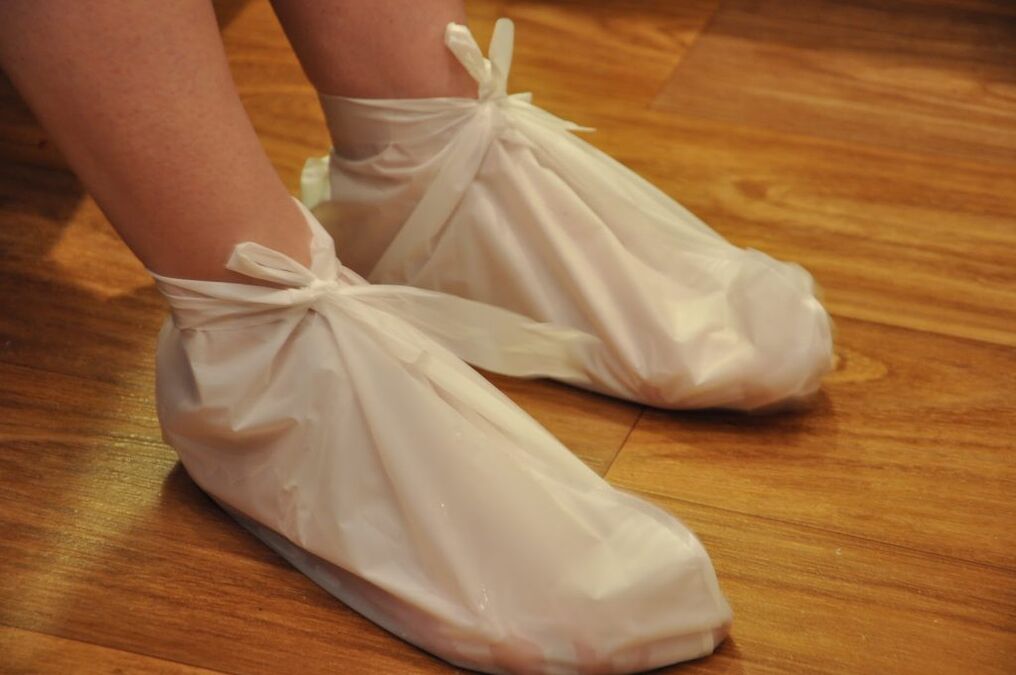 compresses for arthrosis of the ankle