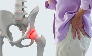 causes of osteoarthritis of the hip